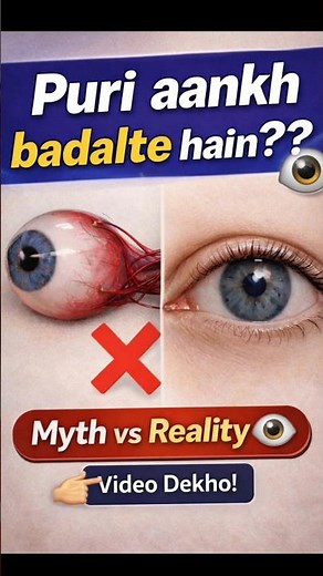 Cornea Transplant Explained| Myth vs Fact. #eyes #eyecondition #eyedisorder #facts #cornea