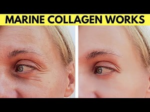 Marine collagen before and after