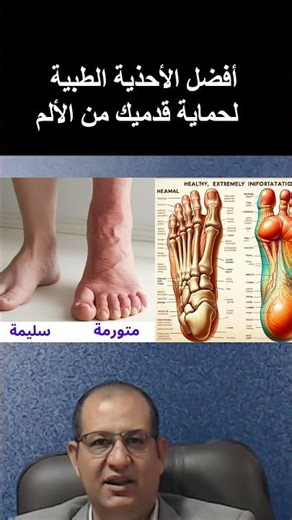 الأحذية المناسبة للوقاية من ترسب الأملاح في القدمين تمنع الألم وتحمي المفاصل