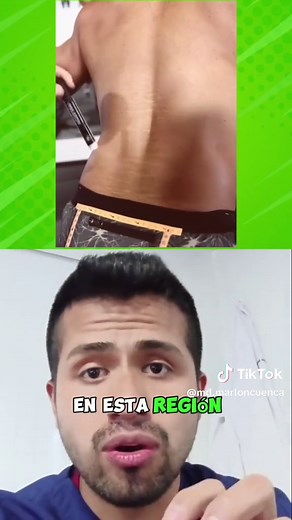 Estrías en la Espalda: Causas y Tratamientos