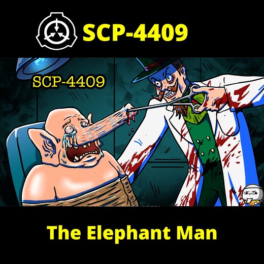 389K views · 8.2K reactions | SCP-4409, also known as The Elephant Man, is an elderly, obese human male of African ancestry, exhibiting numerous elephantine traits. "SCP-4409" was created by awesome author "DrChandra", from the SCP Wiki. Source: https://scp-wiki.wikidot.com/SCP-4409. Licensed under CC-BY-SA 3.0. Music by Gravity Sound: https://www.youtube.com/watch?v=ziFxpjRbfJc | TheRubber | Facebook