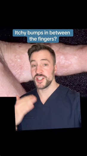 17K views · 204 reactions | Itchy finger bumps | Dermarkologist | Facebook