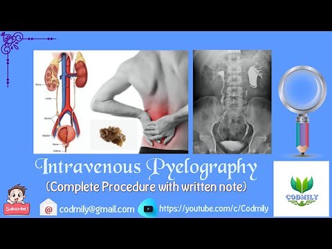 Complete IVP Procedure|IVU