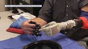 Star Wars-inspired bionic arm helps users control device with their mind