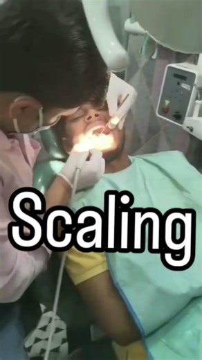 Dental TreatmentsPoor oral hygiene Pyria and gum disease Daily brushing#hightlight #dentalhealth