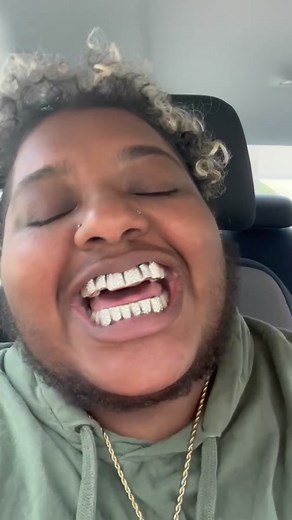 Custom Gold Grillz Review: Fully Bust Down Style | Are They Legit?