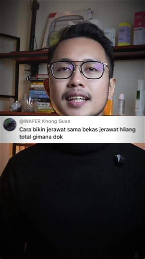 Cara bikin jerawat dan bekas jerawat hilang total, kamu bisa coba lakuin 3 hal ini. #jerawat #bekasjerawat #polahidup #skincarerutin #fypindonesia