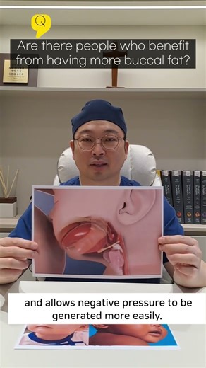 Are there people who benefit from having more buccal fat?