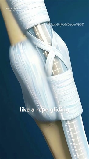Trigger finger release surgery (3D animation) #theflash #healthyparenting #3danimation #science