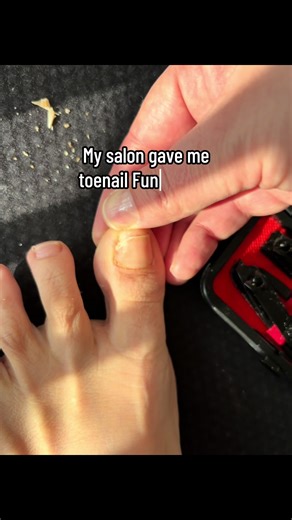 Healing Toenail Fungus: My Journey and Tips