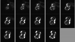 File:Acute-Manipulation-of-Diacylglycerol-Reveals-Roles-in-Nuclear-Envelope-Assembly-&-Endoplasmic-pone.0051150.s008.ogv - Wikimedia Commons