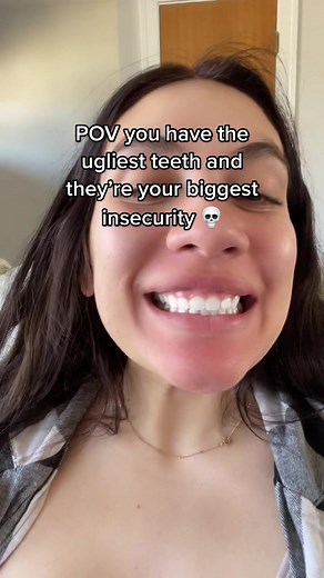 All gums no teeth 😪 | Small Teeth