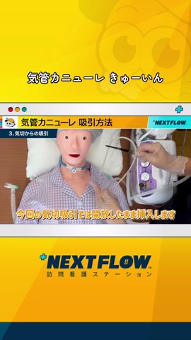 気管カニューレと吸引方法の解説