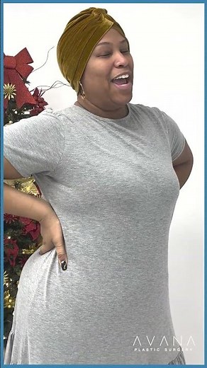 4 days post op: Lipo 360 + BBL with Dr Mameniskis l Avana Plastic Surgery