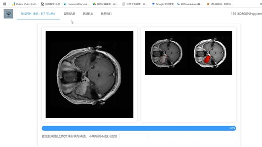 基于 Unet 的脑肿瘤 MRI 分割系统（网页）