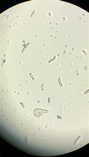 This Is What Bacteria Actually Looks Like #microscope #science #shorts