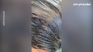 Extreme Lice Removal