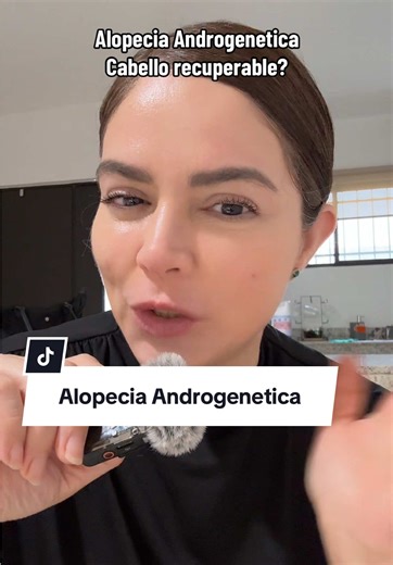Alopecia Androgenética: Tratamientos y Cuidados