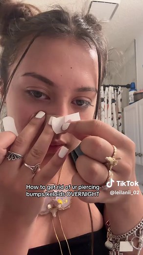 Overnight Tips to Eliminate Piercing Bumps and Keloids