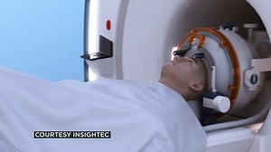 Researchers may have answer to why COVID patients develop 'brain fog'