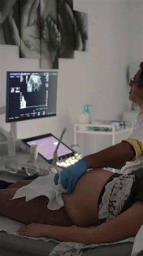 15K views · 40 reactions | Monitorizarea unei sarcini presupune mai...