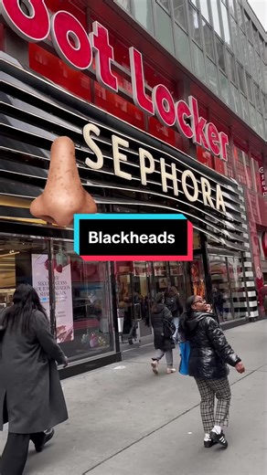 Derm helps you 💪🏻 black heads! #acne #blackheads #skincare #sephora | blackhead