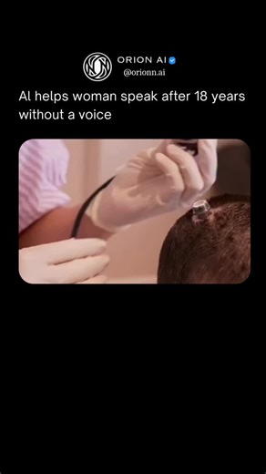 Orion AI on Instagram: "🧠 When thought becomes voice again After 18 years without speech, Ann is able to communicate once more using a brain implant paired with a digital avatar. The system restores not just words, but facial expressions that reflect how she naturally speaks. Researchers at University of California San Francisco implanted a device that reads signals directly from her brain. Those signals are decoded in real time and transformed into text, synthetic speech, and expressive facial
