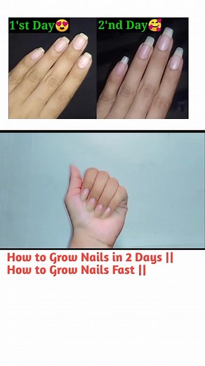 How to Grow Your Nails in 2 Days: Effective Tips