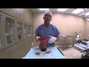 Will Gynecomastia Return After Surgery by Dr. Lebowitz in Huntington Long Island NY