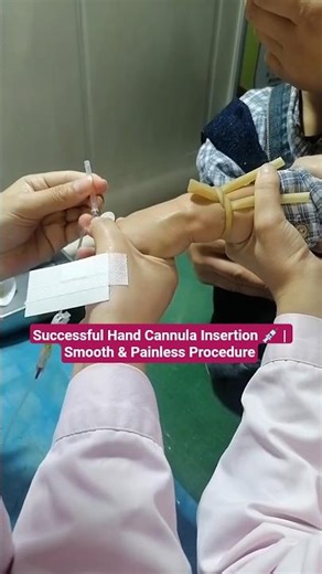 Successful Hand Cannula Insertion 💉 | Smooth & Painless Procedure #youtubeshorts #hospital #reels