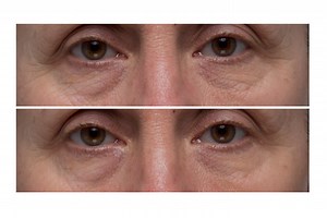 Dr. Denese Wrinkle Rx 76% Peptide Solution Concentrate