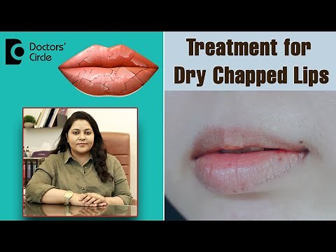 Heal Chapped Lips Fast with these 4 Simple Remedies - Dr. Tina Ramachander | Doctors' Circle