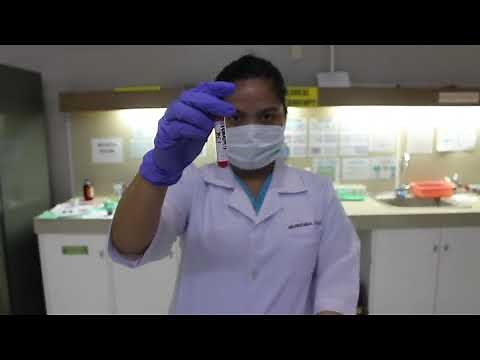 MAJOR CROSSMATCHING GEL METHOD