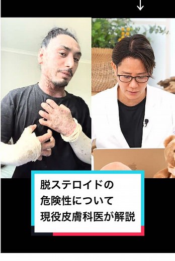 脱ステロイドの危険性について解説する皮膚科医