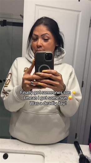 Sunburn Remedies for a Fun Day Outdoors