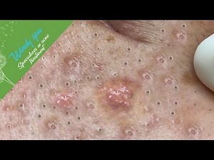 Make Your Day Relaxing with Windy Spa 6#180