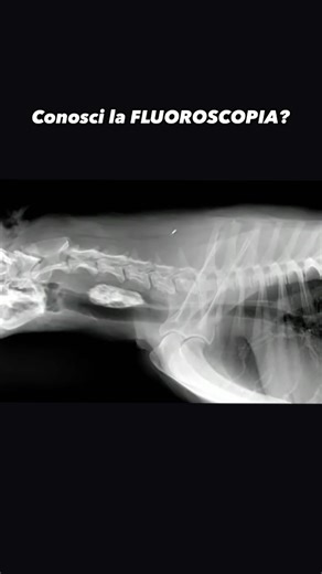 La fluoroscopia è una tecnica radiologica (che si avvale di raggi X) per ottenere immagini in tempo reale dell’anatomia interna di un paziente, attraverso l’uso di un fluoroscopio. La nascita della fluoroscopia digitale ha permesso di ridurre le dosi di radiazioni, elevate in relazione al tempo di esposizione dell’esame diagnostico! Per quanto non possiamo dire che si tratti di un esame totalmente non invasivo (le radiazioni hanno i loro rischi, legati alla cancerogenesi), la fluoroscopia va con