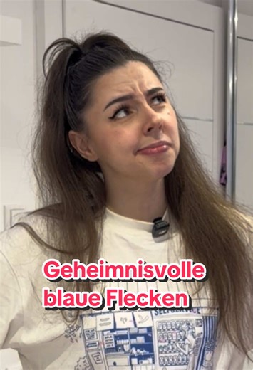 Es gibt keinen Moment an dem ich nicht mindestens einen blauen Fleck an meinem Körper habe, weil ich so verpeilt durch die Welt laufe. 😂 Geht es euch auch so, oder seid ihr normal? 🥴 #fyp #comedy #funnyskit #clumsylife #clumsy