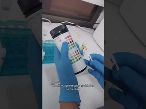 Urinanalysis part 1 Physical Examination of urine in 5 minutes.