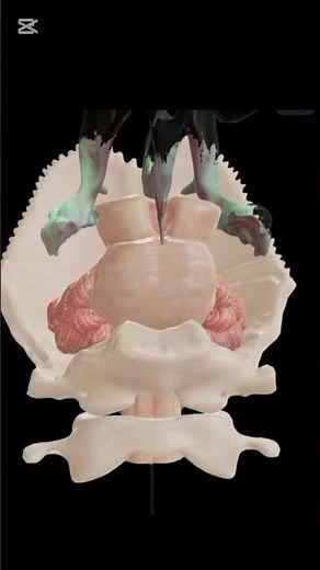 Type 1 chiari malformation #anatomy #humanskull #1millionviews #3danimation #viralvideo