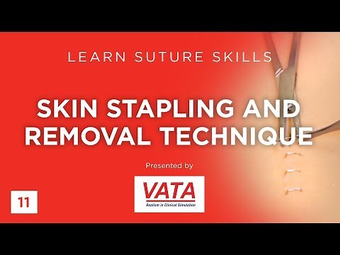 Skin Stapling and Removal Technique - Learn Suture Techniques - VATA