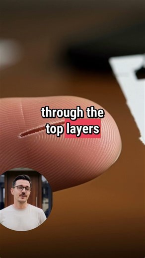 Why Paper Cuts Hurt So Much