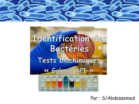 Identification des Bactéries "Galerie biochimique API"