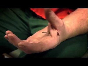 Nail in Hand - Bizarre ER