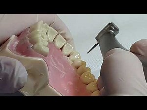 TP Prothèse fixée - préparation 3/4 (PART 2/2)