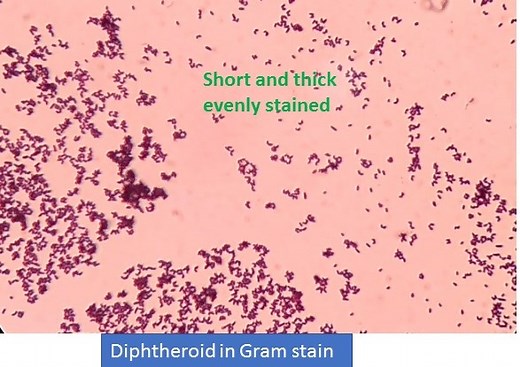 Diphtheroids in gram stain: Introduction, list of diphtheroids and their