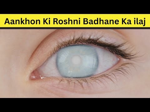 What Is Cataract? | Cataract Symptoms, Causes & Cataract Surgery Explained with Animation