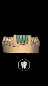 Librería de dientes: Pablo Picasso 🦷 Encuentra nuestras librerías desde el enlace que tenemos en el perfil #exocad #cadcamdental #exocadexpert #prodecad #allonx #anatomiadental #escanerintraoral | Prodecad - Laboratorio Digital de Estética Dental