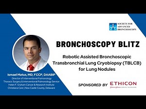 Robotic Assisted Bronchoscopic Transbronchial Lung Cryobiopsy (TBLCB) for Lung Nodules