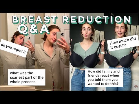 BREAST REDUCTION Q&A: before & after photos!